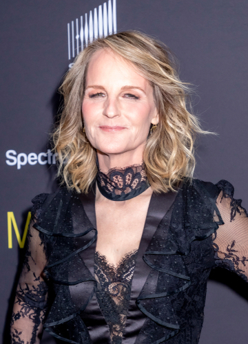 Helen Hunt’s Plastic Surgery 