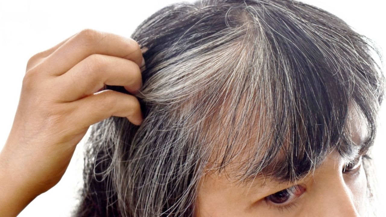 Top 8 Causes of White Hair