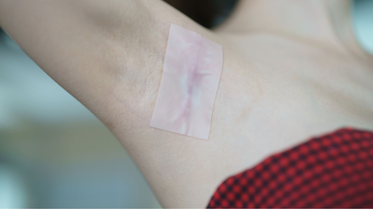 Types of Scars That You Can Use Silicone Scar Sheets on