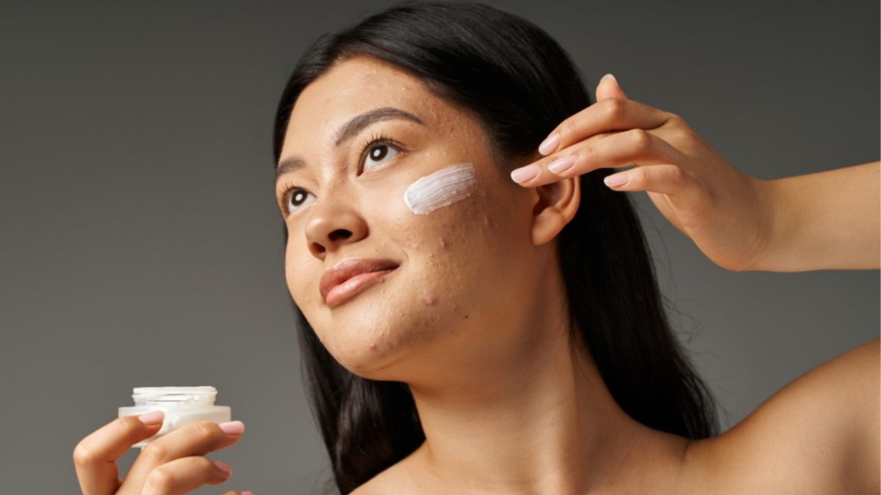 Factors to Consider When Moisturizing Oily Skin with Acne