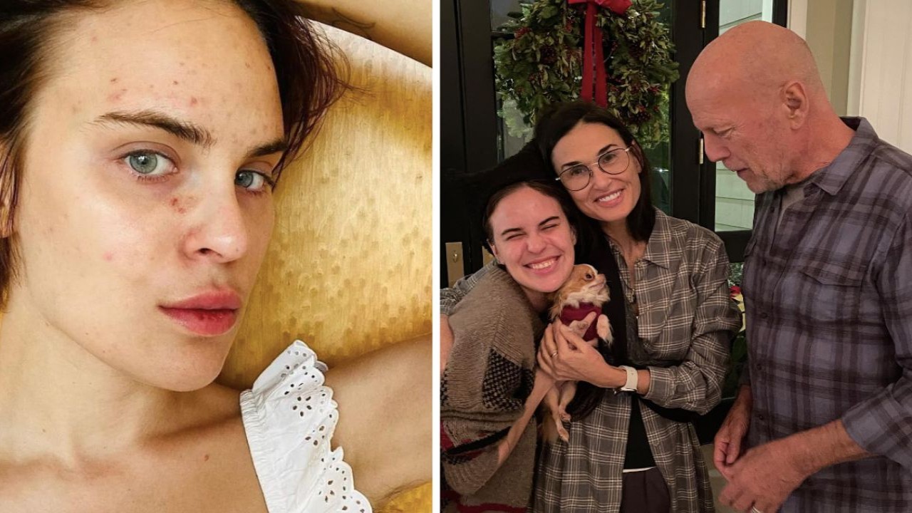 Demi Moore’s Daughter Tallulah Wills Drops Photos Of Her Health Disorder: 'Want So Badly To Share How I Achieved My Win'