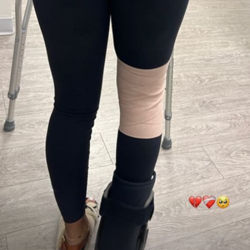 Normani posts her injured leg as she announces withdrawal from 2024 BET Awards