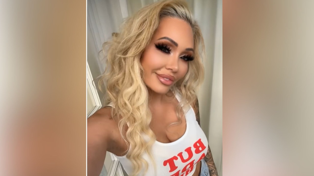 ‘My Mom Had an Aneurysm’: Bunnie XO Reveals Her Biggest ‘Death Scare’ Turned Out To Be a Misdiagnosis