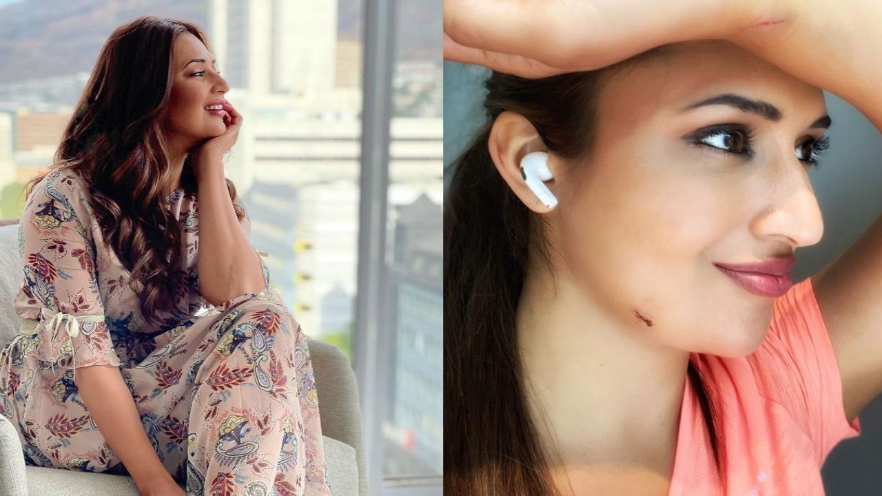 THROWBACK: When Khatron Ke Khiladi 11 star Divyanka Tripathi flaunted crocodile tooth mark on chin and wrist; view pic