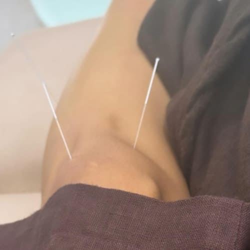 Did Samantha Ruth Prabhu injure herself while shooting action scenes? Actress shares PHOTO from needle treatment session