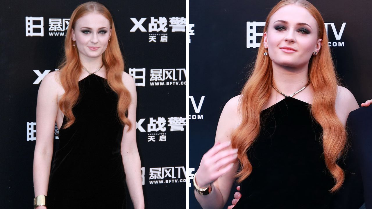 Sophie Turner’s Before Weight Loss Photos