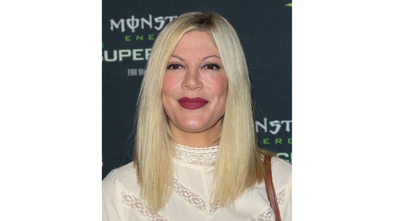 Tori Spelling’s Before And After Plastic Surgery Images