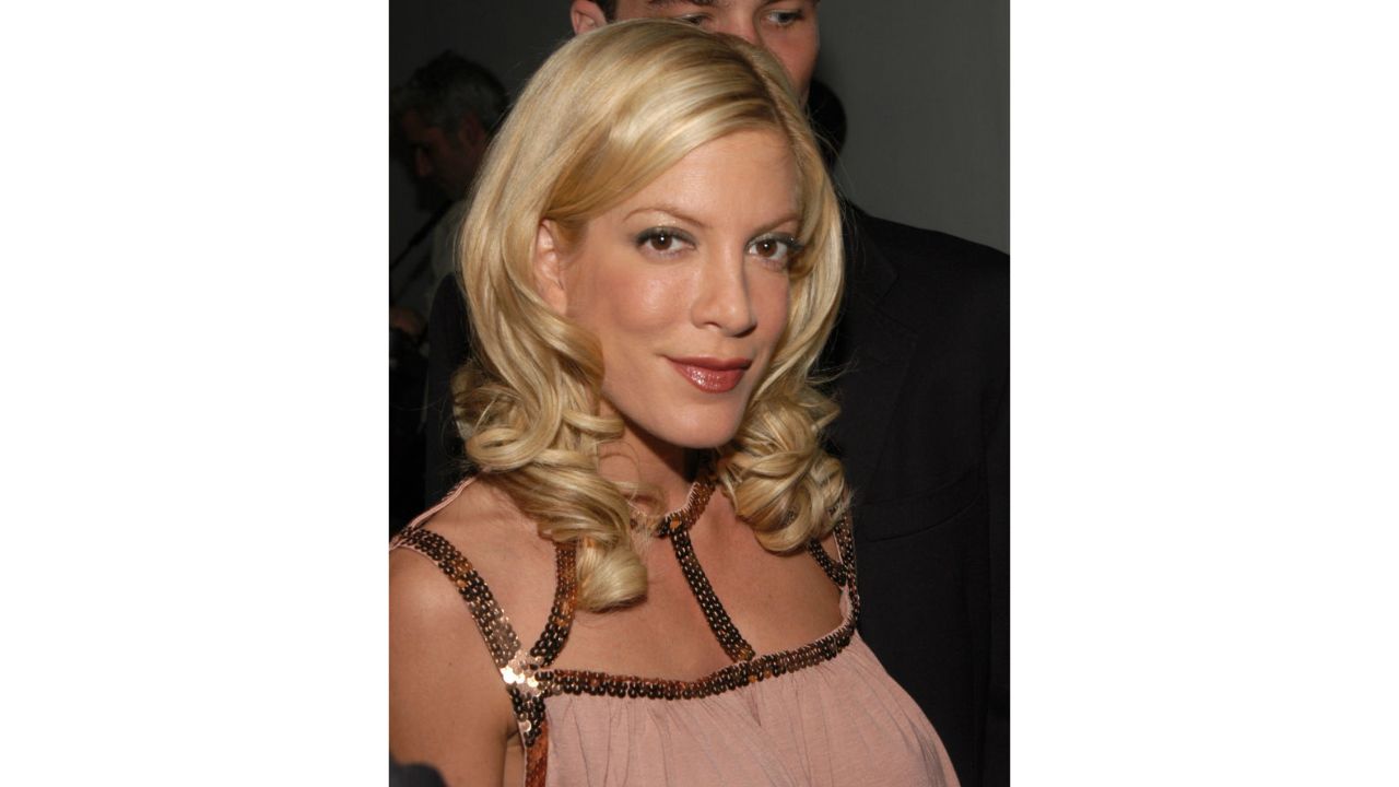 Tori Spelling’s Before And After Plastic Surgery Images