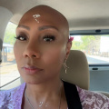 Towanda Braxton is 'Wearing' Her Alopecia Dignosis 'Loud and Proud'; Reveals Why She 'Felt Relieved' After Confirming Her Disorder