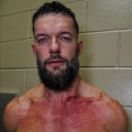 PHOTO: Finn Balor Shows Severe Battle Scars After Brutal Match Against Gunther on WWE Raw