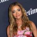 Denise Richards’s Plastic Surgery Experience And Transformation over the Years